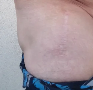 panda_06200 my scars Billede 6