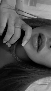 Lillie_Miller Braces 사진 2