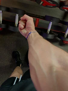veins