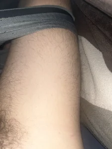 Goldendickinyou Bein Pic 2