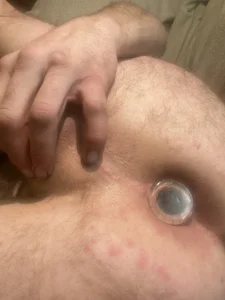 Public od Clamsplitter420  2 snímek