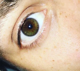 StoneyCam Public Foto