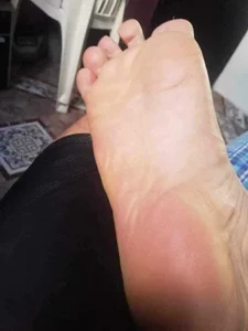 SUDOR20FEET Pies 사진