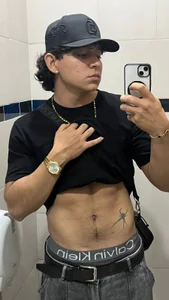 chrollo_callen Public . fénykép