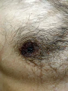 Public de india_cobra  5 photos