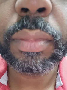 odilicia Public รูป 