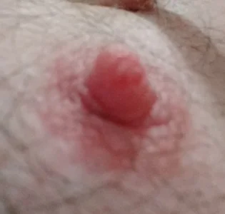 Nippelbilder od 6livekamera@xh  snímek