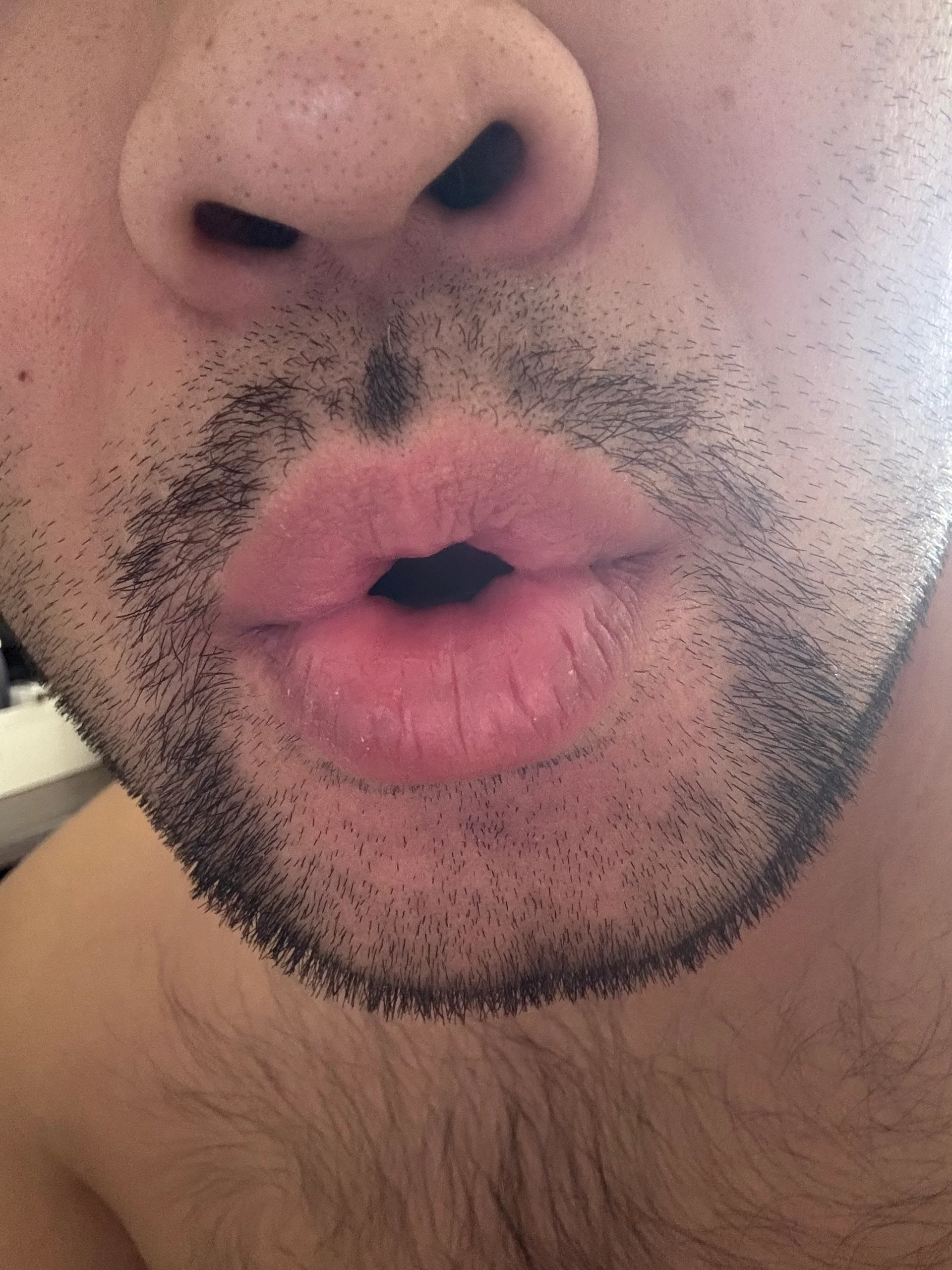 Xdxxdxx333 Public Bilde