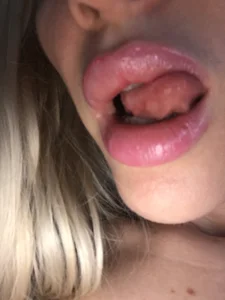 suuzykiss Lips Billede