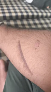 The_Big_Loin_ Public Foto 5