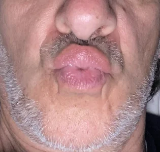 Ocioche Bacio 💋 Billede