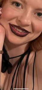 RinaBlondie BRACES TIME Pic 6