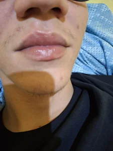 Ss2 de casal_coundray  Imagens