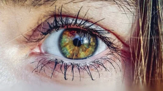 Arlitik eyes :) Kuva