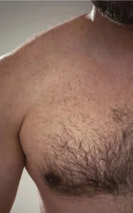 io od xvoglioso69x  snímek