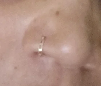 Neha8923 Fgc Immagine 