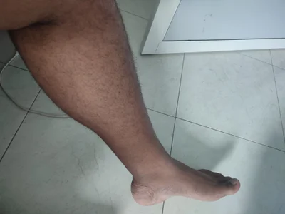 FatCockBoySL My Hairy body Εικόνα 5