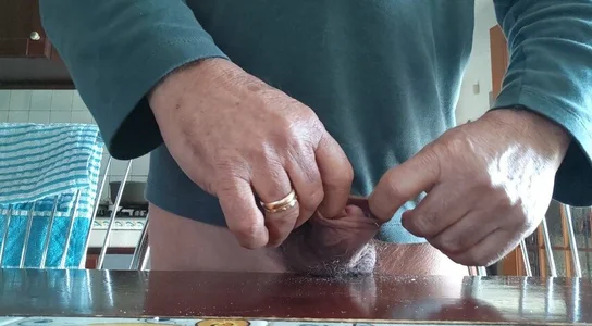 jhonschen's Allargamento prepuzio da 2 cm Sex Photo 7