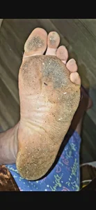 solotoes Feet😉 slika