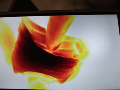 Zdjęcia lilpervt D PEES:  5