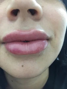 Galahot7 Public Immagine  3