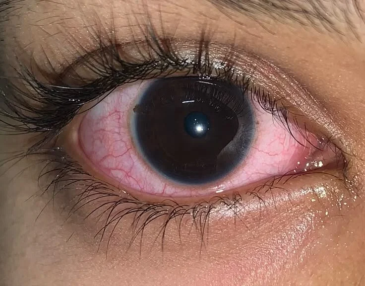 Offline XXX chat Badmind222