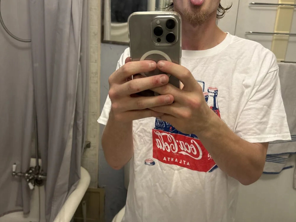 anomalies_ig offline XXX-chat