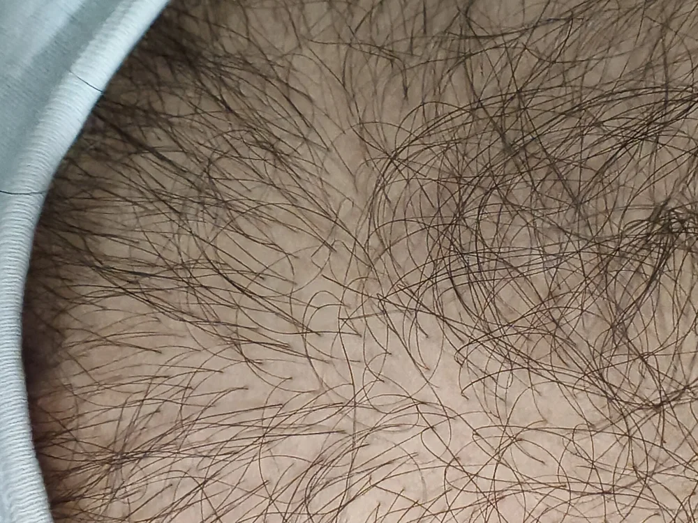 Chat XXX offline de Hairykingh