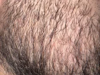 hinnyy's webcam live show