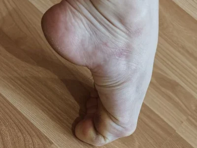 BalletFeet_queen live profile