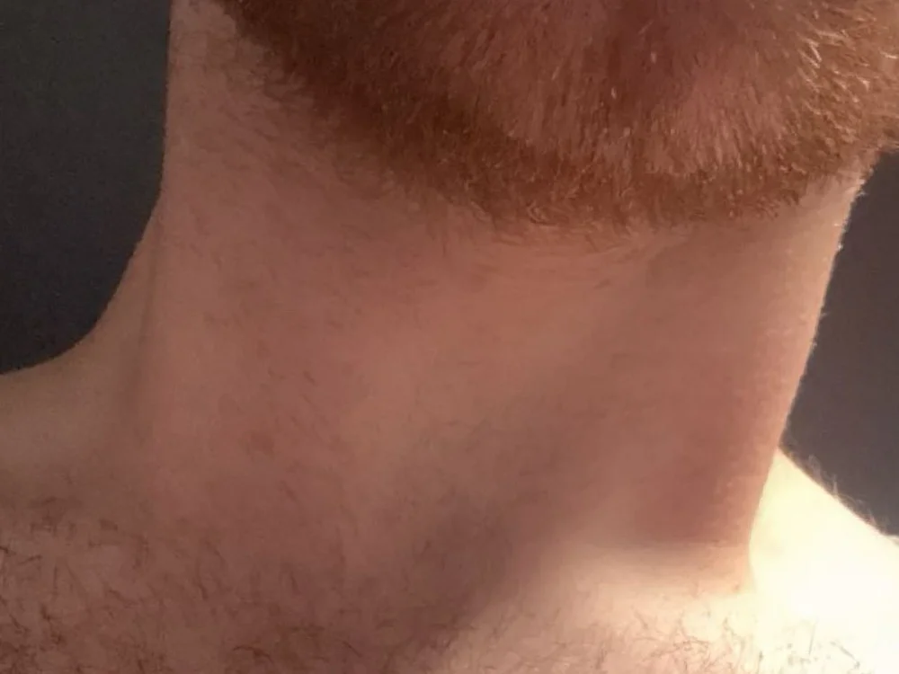 Follka Chat XXX offline