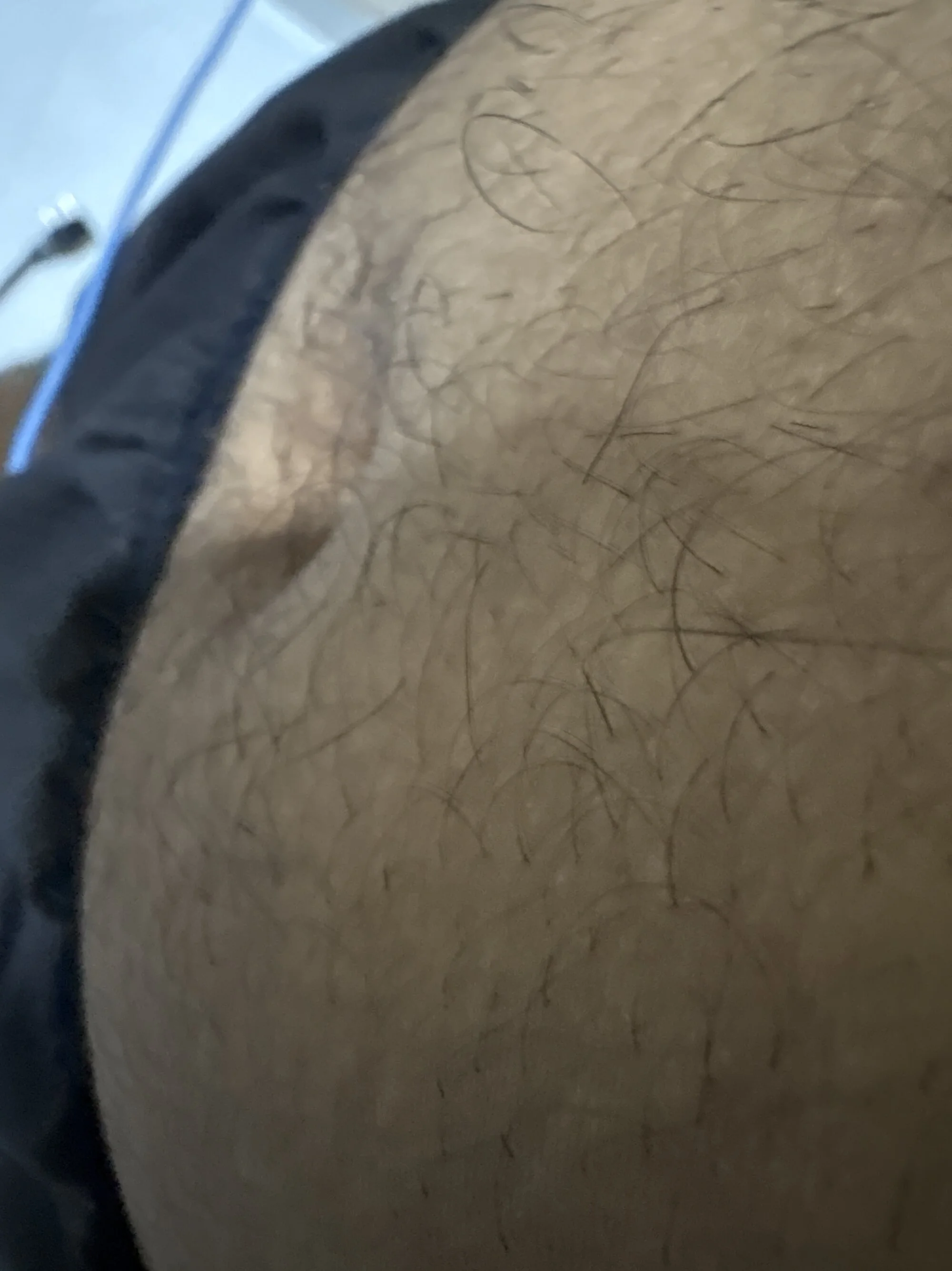 dickyards