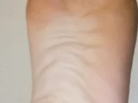 Soriola