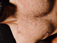 up_hunk_here