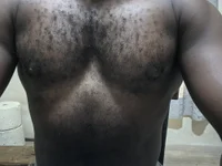 Diclofenack webcam model