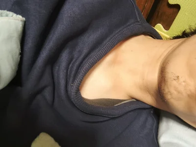 icopann