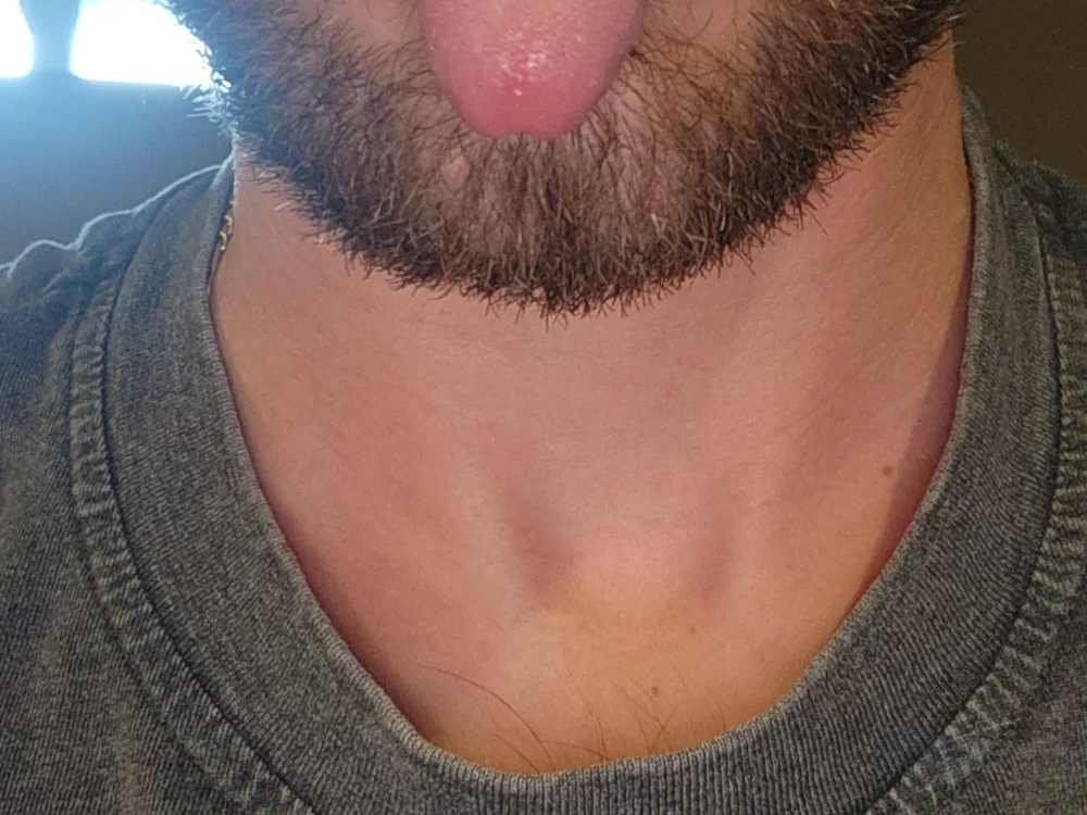 Mrbwc301: συνομιλία ΧΧΧ εκτός σύνδεσης