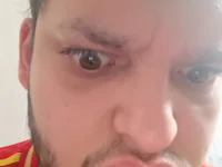 Epollon