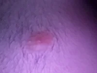 Pauzudopeludo