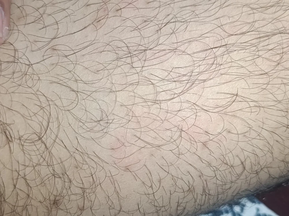 Chikerginni 오프라인 XXX 채팅