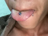 Setalites731