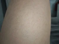 O-malessere's webcam live show