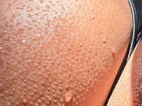 Chat XXX ao vivo de deusaludovica