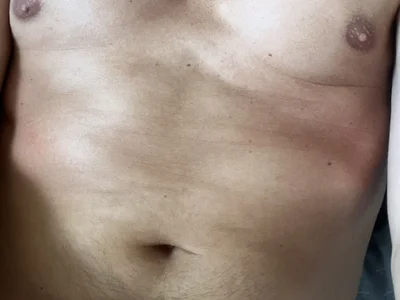 Oskaarr