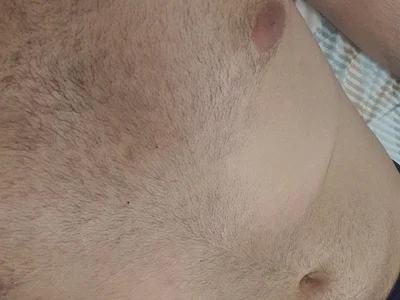 morenomedna2