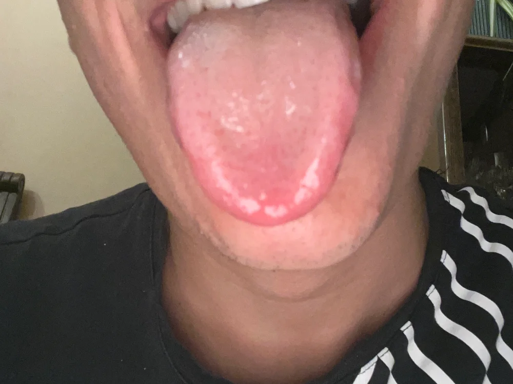 Robkar08