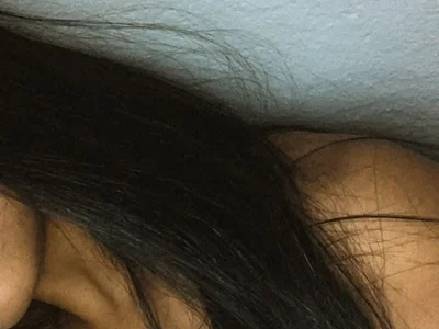allerquina