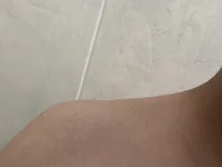 Lilnatal