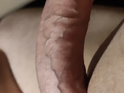 AnnulateVitriol profile