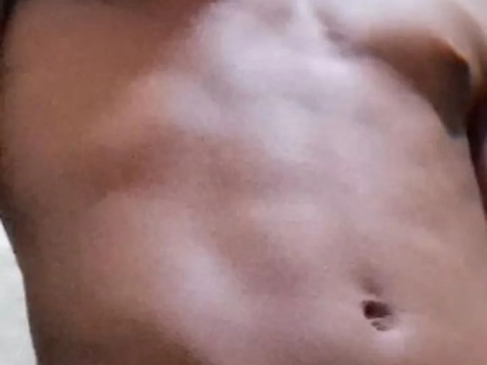 Tffr18